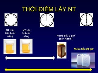 THỜI ĐIỂM LẤY NT
Nước tiểu 24 giờ
Nước tiểu 3 giờ
(cặn Addis)
NT đầu
tiên buổi
sáng
NT bất
kì buổi
sáng
 