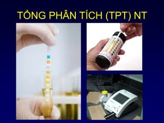 TỔNG PHÂN TÍCH (TPT) NT
 