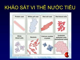KHẢO SÁT VI THỂ NƯỚC TIỂU
 