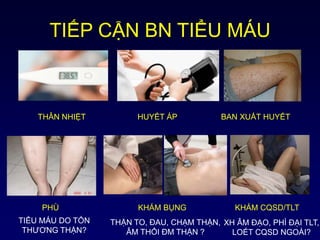 TIẾP CẬN BN TIỂU MÁU
THÂN NHIỆT HUYẾT ÁP BAN XUẤT HUYẾT
PHÙ KHÁM BỤNG KHÁM CQSD/TLT
THẬN TO, ĐAU, CHẠM THẬN,
ÂM THỔI ĐM THẬN ?
XH ÂM ĐẠO, PHÌ ĐẠI TLT,
LOÉT CQSD NGOÀI?
TIỂU MÁU DO TỔN
THƯƠNG THẬN?
 