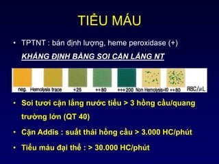 TIỂU MÁU
• TPTNT : bán định lượng, heme peroxidase (+)
KHẲNG ĐỊNH BẰNG SOI CẶN LẮNG NT
• Soi tươi cặn lắng nước tiểu > 3 hồng cầu/quang
trường lớn (QT 40)
• Cặn Addis : suất thải hồng cầu > 3.000 HC/phút
• Tiểu máu đại thể : > 30.000 HC/phút
 