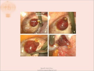 Nguyễn Xuân Khoa -
xuankhoa.nguyen@gmail.com
 