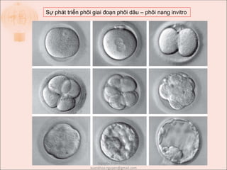 Sự phát triển phôi giai đoạn phôi dâu – phôi nang invitro
Nguyễn Xuân Khoa -
xuankhoa.nguyen@gmail.com
 
