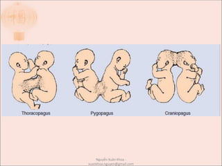 Nguyễn Xuân Khoa -
xuankhoa.nguyen@gmail.com
 