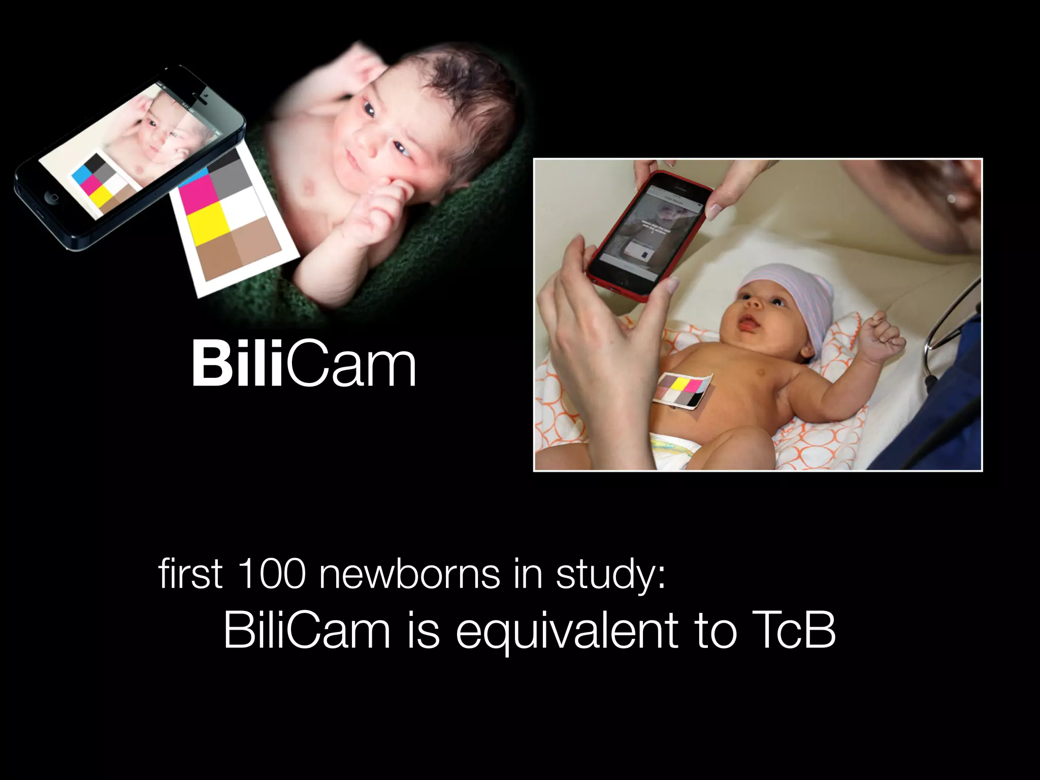 BiliCam
ﬁrst 100 newborns in study:
	 	 	 	 	 BiliCam is equivalent to TcB
 