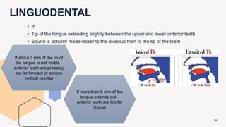 LINGUODENTAL
18
• th
• Tip of the tongue extending slightly between the upper and lower anterior teeth
• Sound is actually made closer to the alveolus than to the tip of the teeth
If about 3 mm of the tip of
the tongue is not visible -
anterior teeth are probably
too far forward or excess
vertical overlap
If more than 6 mm of the
tongue extends out –
anterior teeth are too far
lingual
 