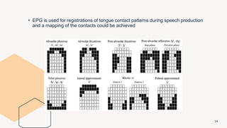 24
• EPG is used for registrations of tongue contact patterns during speech production
and a mapping of the contacts could be achieved
 