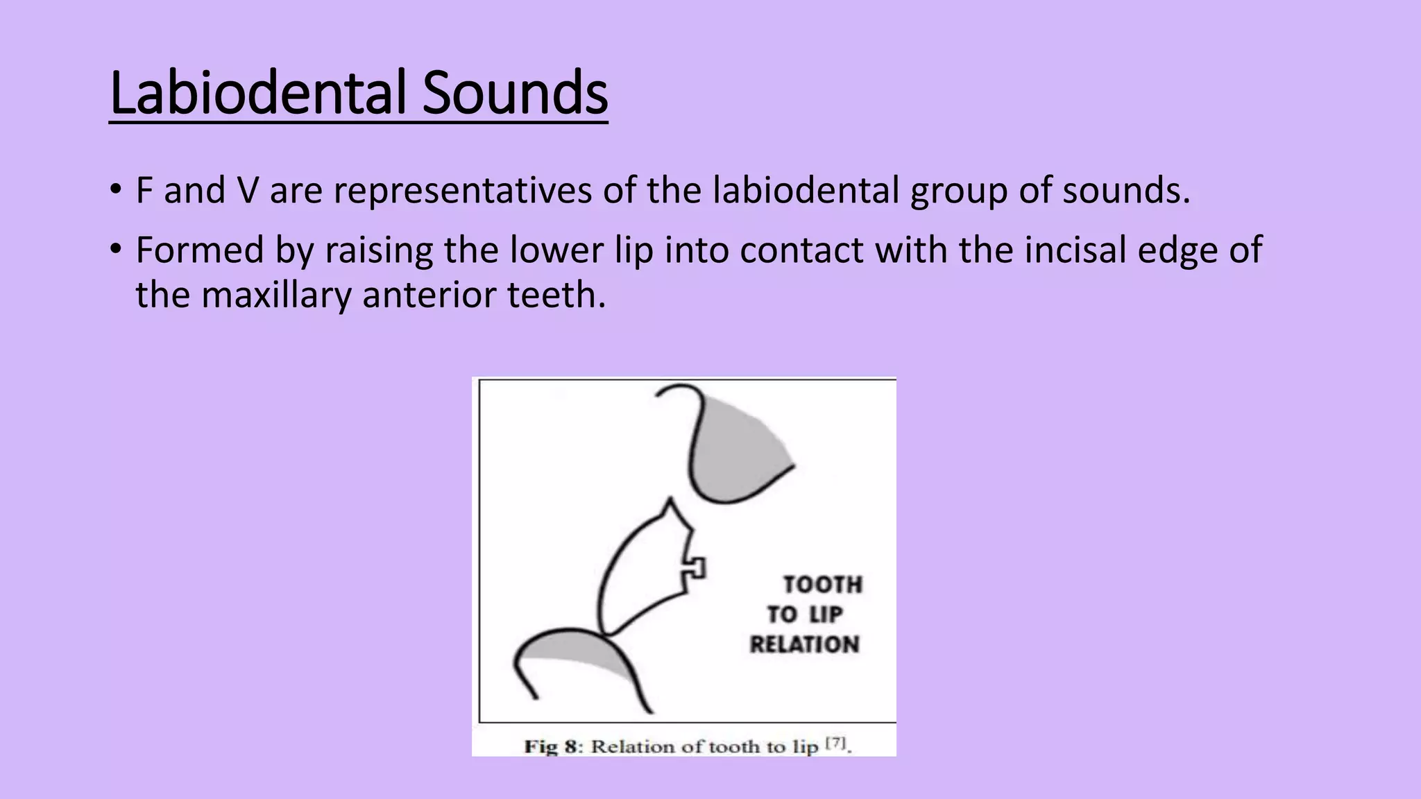Phonetics in Complete Denture.pptx