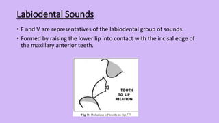 Phonetics in Complete Denture.pptx
