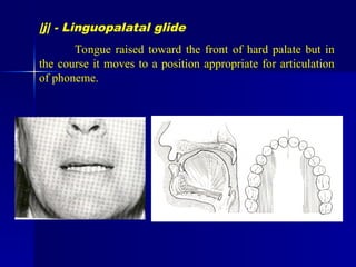 PHONETICS IN COMPLETE DENTURES BASIC.ppt