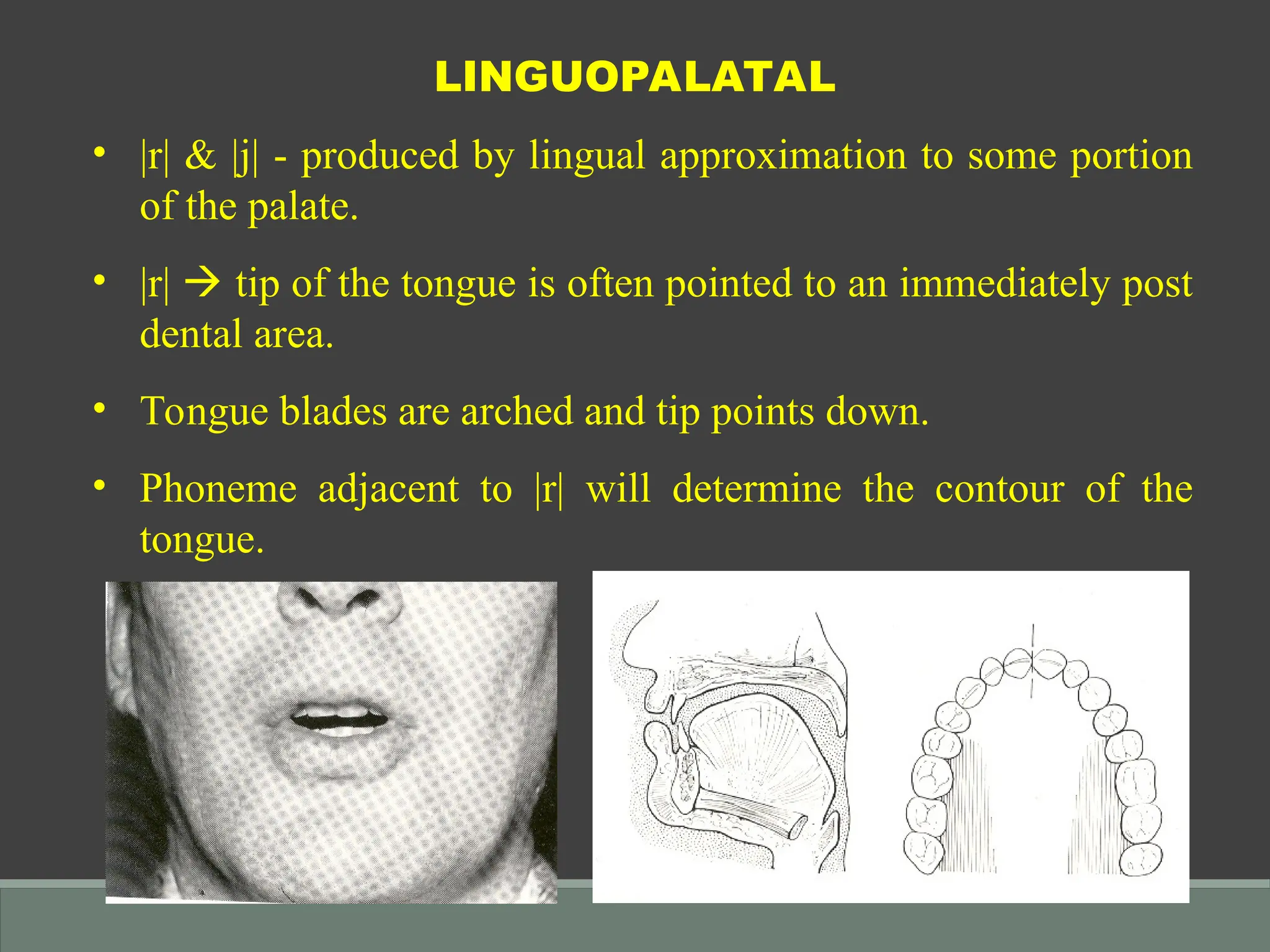 PHONETICS IN COMPLETE DENTURES final.ppt