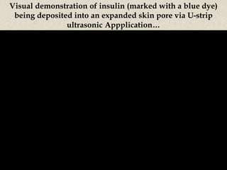 Visual demonstration of insulin (marked with a blue dye)
being deposited into an expanded skin pore via U-strip
ultrasonic Appplication…
 