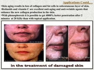 •Skin aging results in loss of collagen and fat cells in subcutaneous layer of skin.
•Retinoids and vitamin C are excellent anti-aging and anti-wrinkle agents that
enhance the new collagen production in the skin.
•With phonophoresis it is possible to get 4000% better penetration after 2
minutes at 20 KHz than with topical application.
Applications Contd,…
 