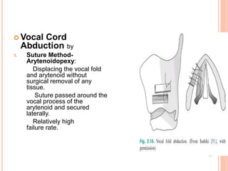 Phonosurgery | PPTX