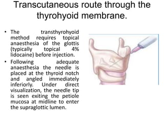 Transcricothyroid Injection Phonosurgery | PPTX