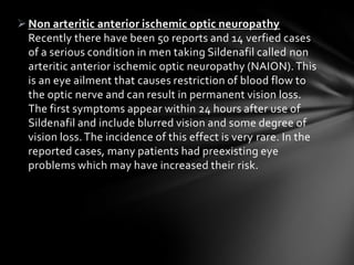 Non arteritic anterior ischemic optic neuropathy
Recently there have been 50 reports and 14 verfied cases
of a serious condition in men taking Sildenafil called non
arteritic anterior ischemic optic neuropathy (NAION).This
is an eye ailment that causes restriction of blood flow to
the optic nerve and can result in permanent vision loss.
The first symptoms appear within 24 hours after use of
Sildenafil and include blurred vision and some degree of
vision loss. The incidence of this effect is very rare. In the
reported cases, many patients had preexisting eye
problems which may have increased their risk.
 