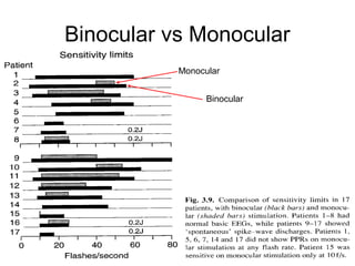 Binocular vs Monocular
Binocular
Monocular
 