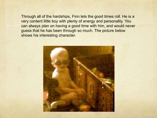 Through all of the hardships, Finn lets the good times roll. He is a very content little boy with plenty of energy and personality. You can always plan on having a good time with him, and would never guess that he has been through so much. The picture below shows his interesting character.