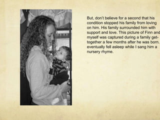 But, don’t believe for a second that his condition stopped his family from lovingon him. His family surrounded him withsupport and love. This picture of Finn andmyself was captured during a family get-together a few months after he was born. Heeventually fell asleep while I sang him anursery rhyme.  