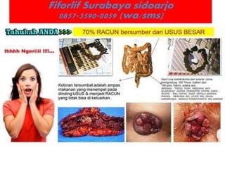 Fiforlif Surabaya sidoarjo
0857-3590-0059 (wa/sms)
 