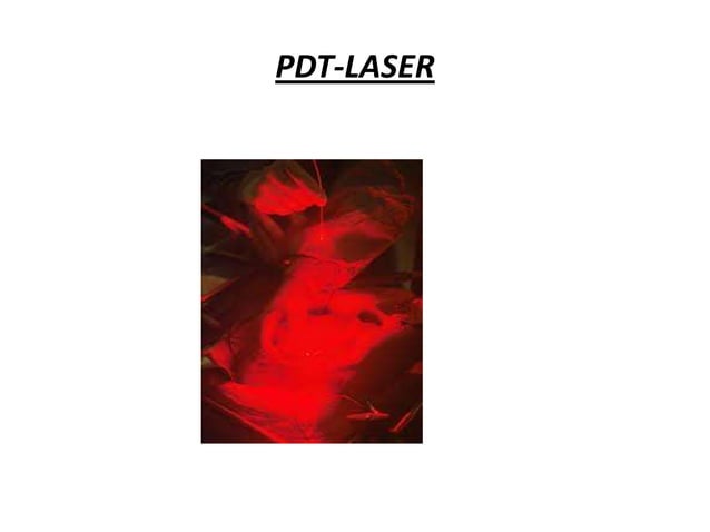 Photo dynamic therapy | PPTX