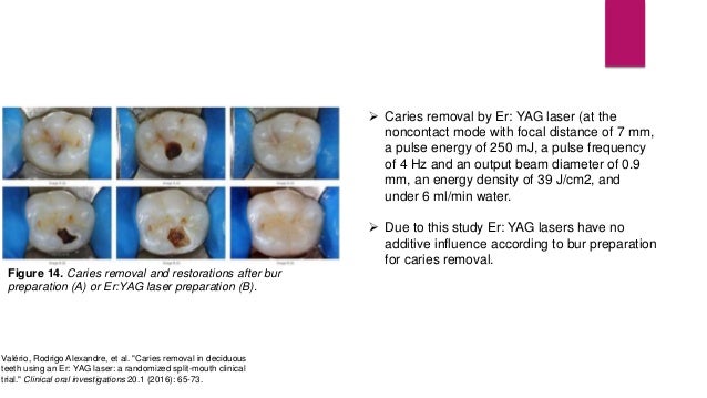 Photodynamic therapy, photothermal therapy, photoablation
