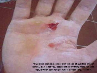“ If you like pealing pieces of skin the size of quarters of your hands... bars is for you. Because the only thing more fun then rips, is when your rips get rips. It's super sexy.” –Stick It 
