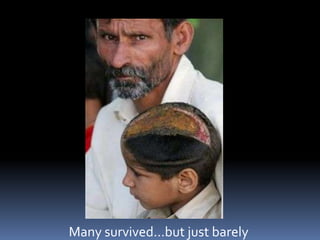 Many survived…but just barely
 