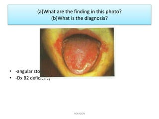 Photo for child osce final version whh 1 (1) | PPTX