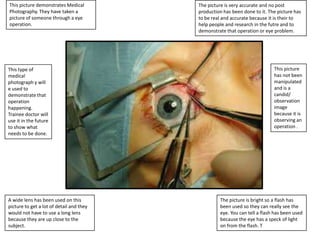 This picture demonstrates Medical
Photography. They have taken a
picture of someone through a eye
operation.

This type of
medical
photograph y will
e used to
demonstrate that
operation
happening.
Trainee doctor will
use it in the future
to show what
needs to be done.

A wide lens has been used on this
picture to get a lot of detail and they
would not have to use a long lens
because they are up close to the
subject.

The picture is very accurate and no post
production has been done to it. The picture has
to be real and accurate because it is their to
help people and research in the futre and to
demonstrate that operation or eye problem.

This picture
has not been
manipulated
and is a
candid/
observation
image
because it is
observing an
operation .

The picture is bright so a flash has
been used so they can really see the
eye. You can tell a flash has been used
because the eye has a speck of light
on from the flash. T

 
