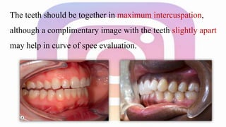 Photography in Orthodontics | PPTX
