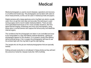 Medical
Medical photography is used to record diseases, operations and recovery
in a truthful and honest way. The photographs can be taken with rulers to
show measurements, so this can be used in medical journals and papers.
Digital cameras with a large apertures and a ring flash are what is usually
used, this is to get the most clear and accurate, this technique is used
during surgery and to record visible medical problems. There are also
more specialised techniques to fit in more complex situations, like time
lapse thermal imaging, endoscopy and micro and macorgraphy, using
these when a normal camera cant capture the full accuracy and detail like
internal organs.
The conditions that the photographs are taken in are controlled and have
to be manipulated in a way that follows medical standards. Lighting for
photographs depend on the situation. If it is posed in studio then lighting
will be artificial lamps, if its in surgery the photographer will have to use
the ambient light with the ring flash to get the right lighting.
The people who do this job are medical photographers that are specially
trained.
Editing and post production is not allowed in these photos as they will taint
the outcome of what the ‘disease’ looks like 100% truthfully.
 
