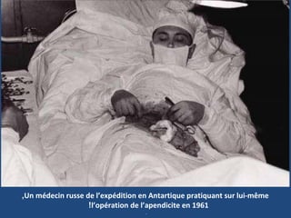 Un médecin russe de l’expédition en Antartique pratiquant sur lui-même,
l’opération de l’apendicite en 1961!
.
 