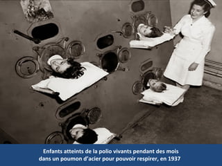 Enfants atteints de la polio vivants pendant des mois
dans un poumon d’acier pour pouvoir respirer, en 1937
 