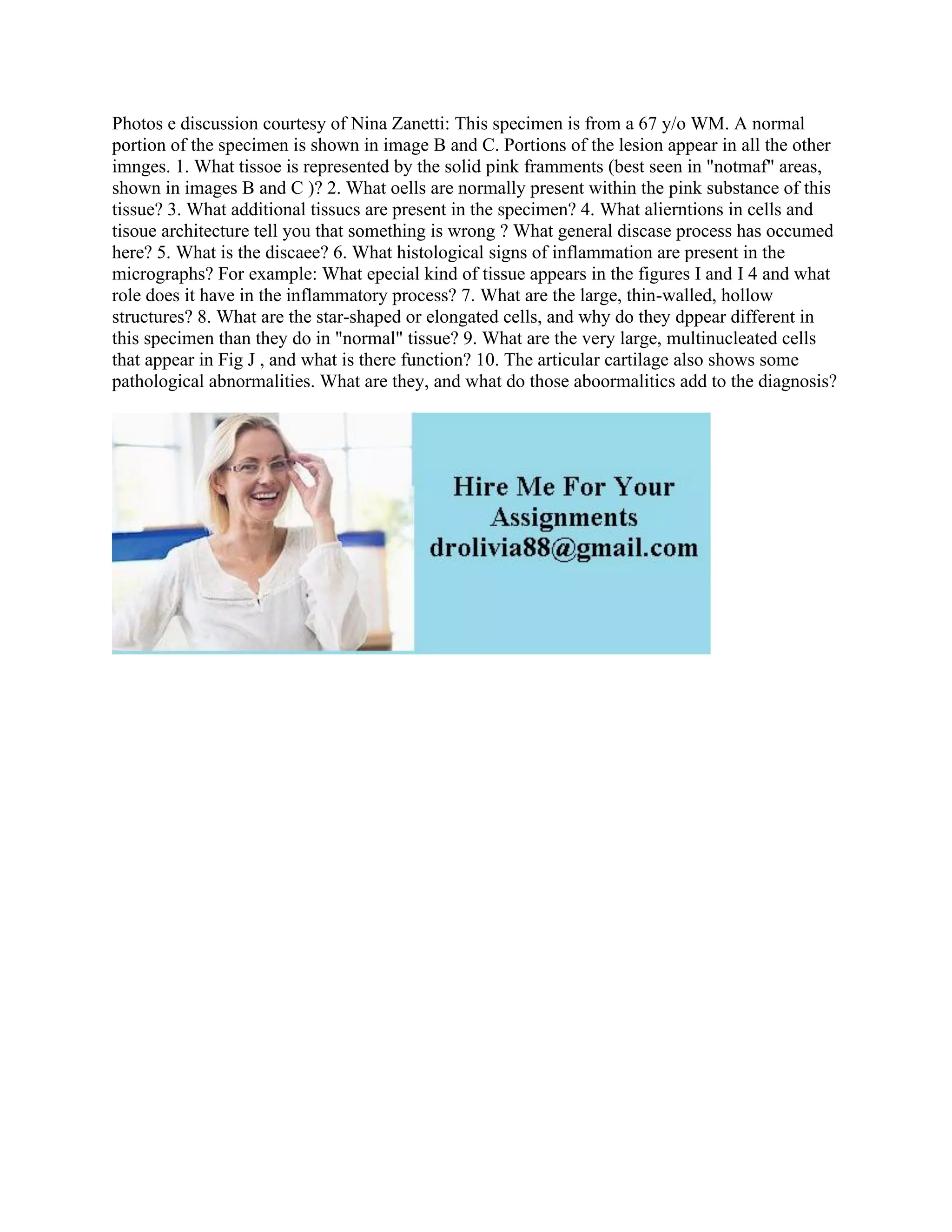 Photos e discussion courtesy of Nina Zanetti: This specimen is from a 67 y/o WM. A normal
portion of the specimen is shown in image B and C. Portions of the lesion appear in all the other
imnges. 1. What tissoe is represented by the solid pink framments (best seen in "notmaf" areas,
shown in images B and C )? 2. What oells are normally present within the pink substance of this
tissue? 3. What additional tissucs are present in the specimen? 4. What alierntions in cells and
tisoue architecture tell you that something is wrong ? What general discase process has occumed
here? 5. What is the discaee? 6. What histological signs of inflammation are present in the
micrographs? For example: What epecial kind of tissue appears in the figures I and I 4 and what
role does it have in the inflammatory process? 7. What are the large, thin-walled, hollow
structures? 8. What are the star-shaped or elongated cells, and why do they dppear different in
this specimen than they do in "normal" tissue? 9. What are the very large, multinucleated cells
that appear in Fig J , and what is there function? 10. The articular cartilage also shows some
pathological abnormalities. What are they, and what do those aboormalitics add to the diagnosis?