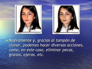 Nuevamente y, gracias al tampón de clonar, podemos hacer diversas acciones, como, en este caso, eliminar pecas, granos, ojeras, etc. 