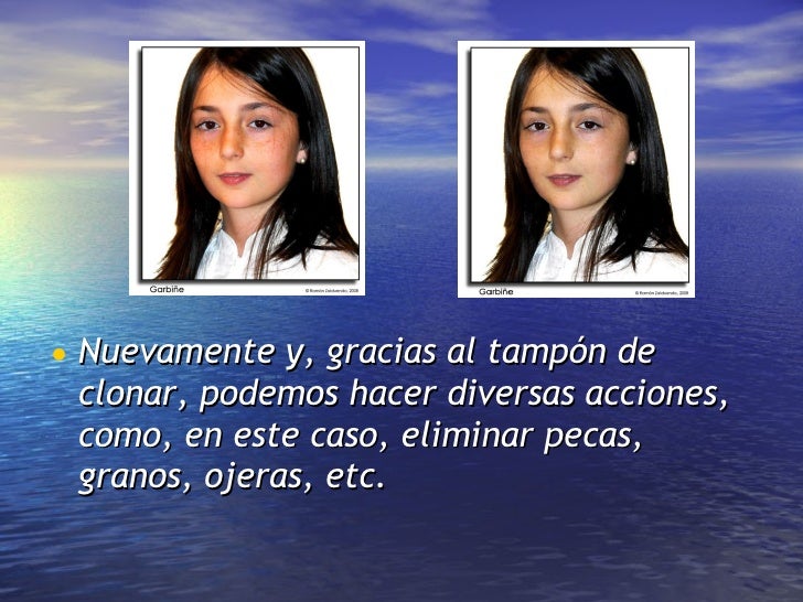 Se librará de las pecas por las vitaminas
