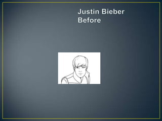 	Justin BieberBefore 