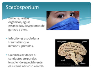 ScedosporiumEn tierra, restos orgánicos, aguas estancadas, deyecciones de ganado y aves.Infecciones asociadas a traumatismos o inmunosuprimidos.Coloniza cavidades o conductos corporales invadiendo especialmente el sistema nervioso central.
