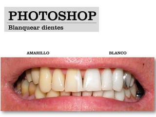 PHOTOSHOP
Blanquear dientes



     AMARILLO       BLANCO
 