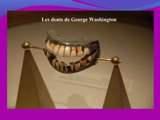 Les dents de George Washington
 