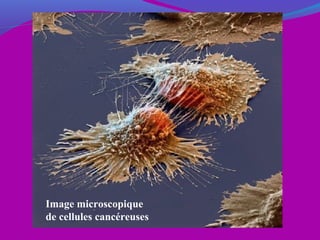 Image microscopique
de cellules cancéreuses
 