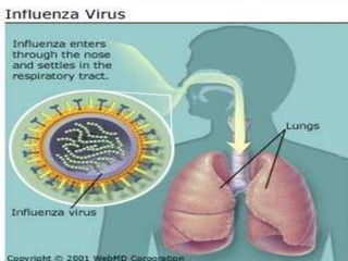 Photos Of Influenza