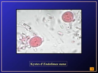 Kystes d’Endolimax nana
 