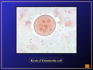 Kyste d’Entamoeba coli
 