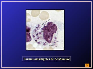 Formes amastigotes de Leishmania
 