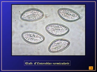 Œufs d’Enterobius vermicularis
 