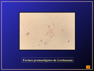 Formes promastigotes de Leishmania
 