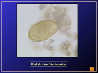 Œuf de Fasciola hepatica
 