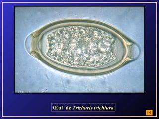 Œuf de Trichuris trichiura
 